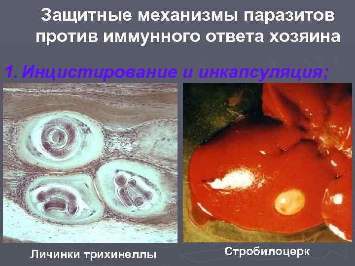 Защитные механизмы паразитов против иммунного ответа хозяина 1. Инцистирование и инкапсуляция; Личинки трихинеллы Стробилоцерк