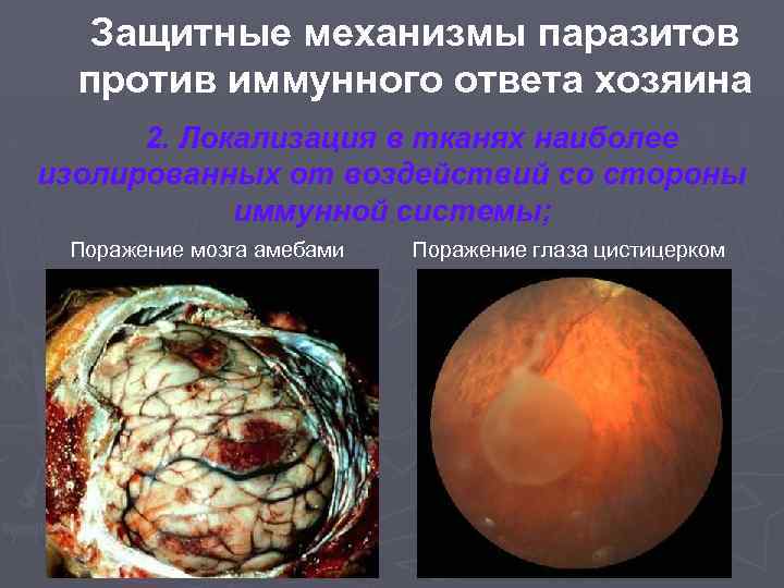 Защитные механизмы паразитов против иммунного ответа хозяина 2. Локализация в тканях наиболее изолированных от