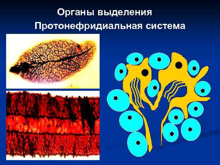 Органы выделения Протонефридиальная система 