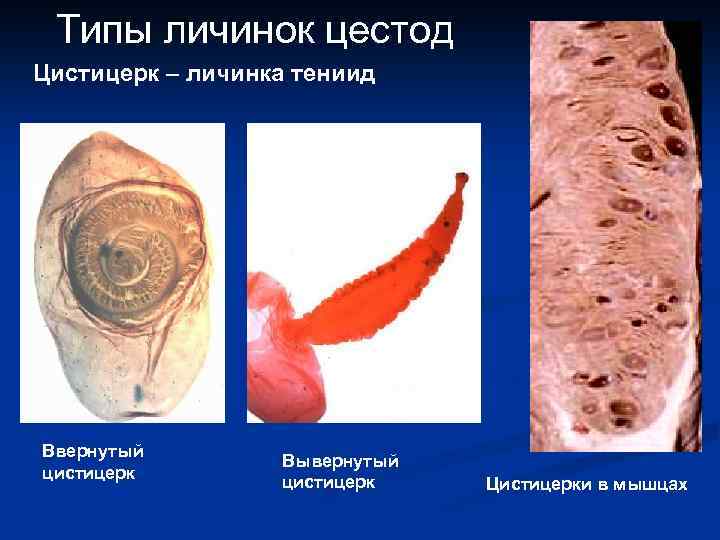 Типы личинок цестод Цистицерк – личинка тениид найти Ввернутый цистицерк Вывернутый цистицерк Цистицерки в