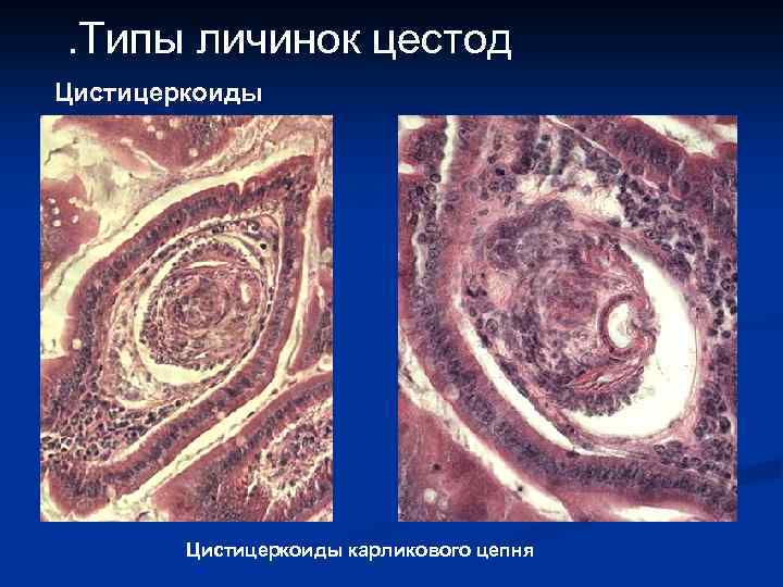 . Типы личинок цестод Цистицеркоиды найти Цистицеркоиды карликового цепня 