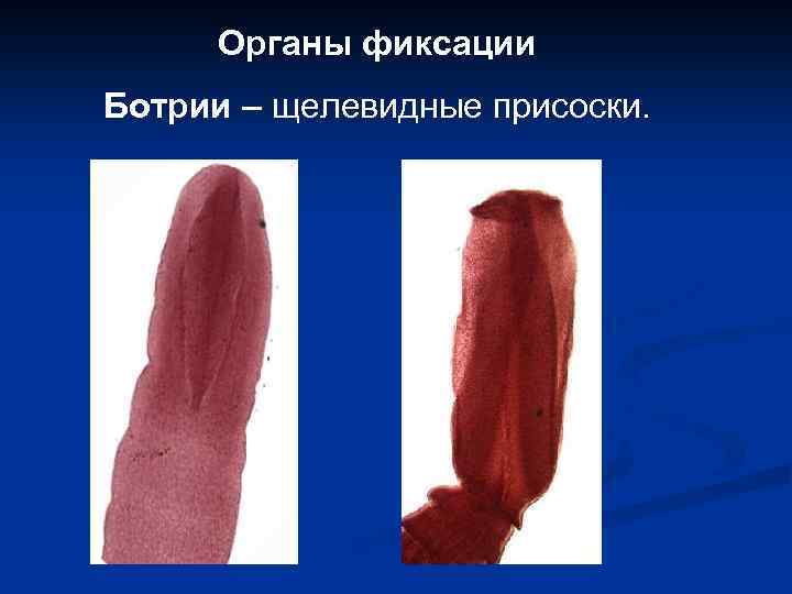 Органы фиксации Ботрии – щелевидные присоски. 