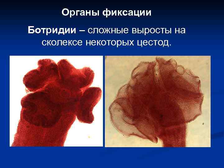 Органы фиксации Ботридии – сложные выросты на сколексе некоторых цестод. 