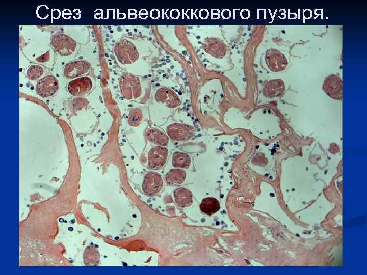 Срез альвеококкового пузыря. 