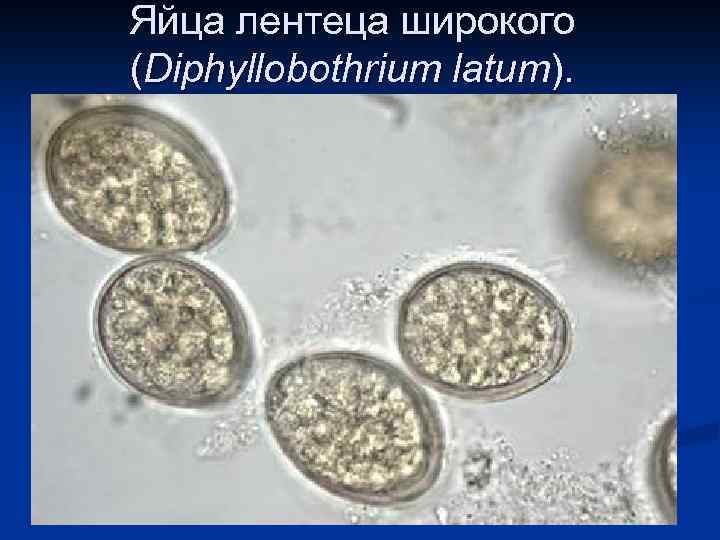 Яйца лентеца широкого (Diphyllobothrium latum). 