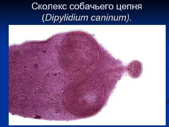 Сколекс собачьего цепня (Dipylidium caninum). 