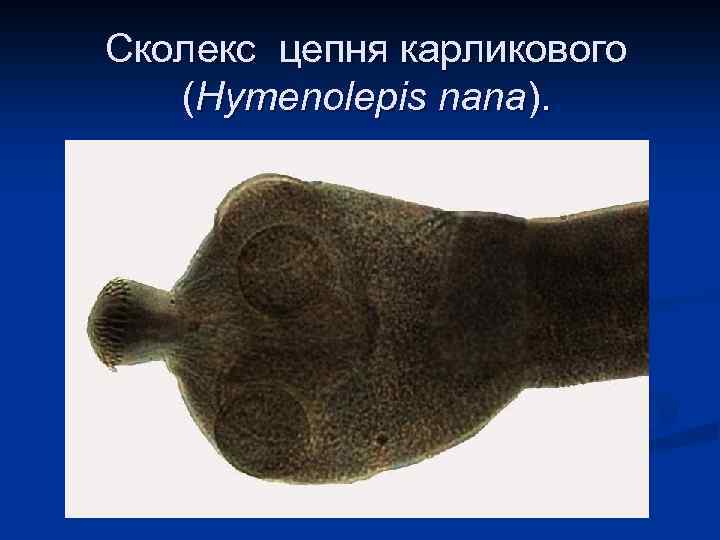 Сколекс цепня карликового (Hymenolepis nana). 