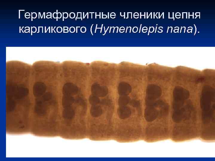 Гермафродитные членики цепня карликового (Hymenolepis nana). 