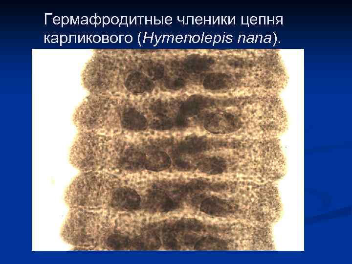 Гермафродитные членики цепня карликового (Hymenolepis nana). 