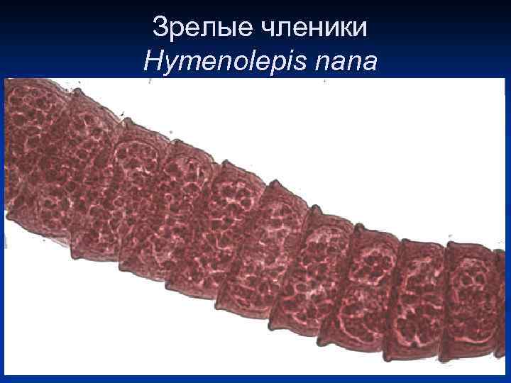 Зрелые членики Hymenolepis nana 