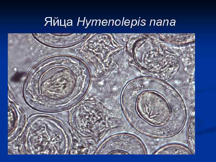 Яйца Hymenolepis nana 