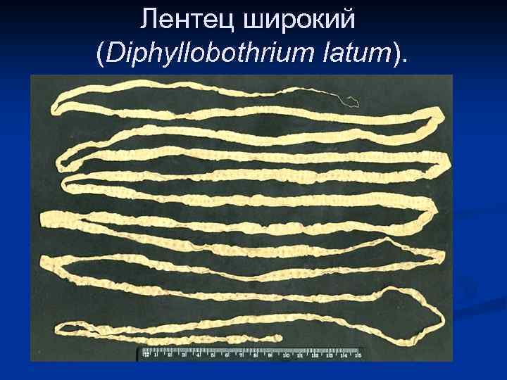 Лентец широкий (Diphyllobothrium latum). 