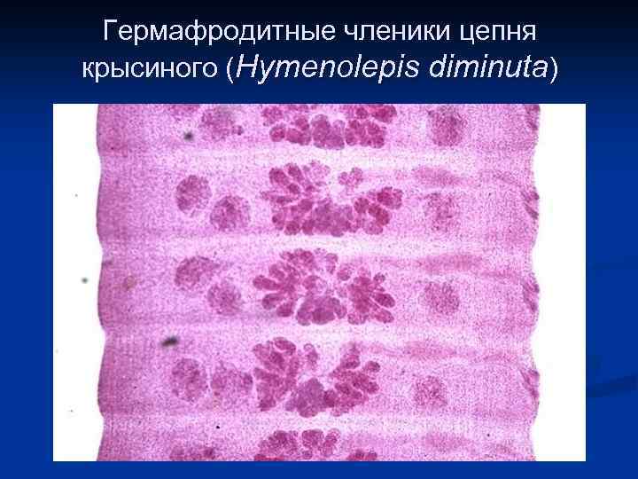 Гермафродитные членики цепня крысиного (Hymenolepis diminuta) 