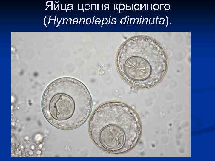 Яйца цепня крысиного (Hymenolepis diminuta). 