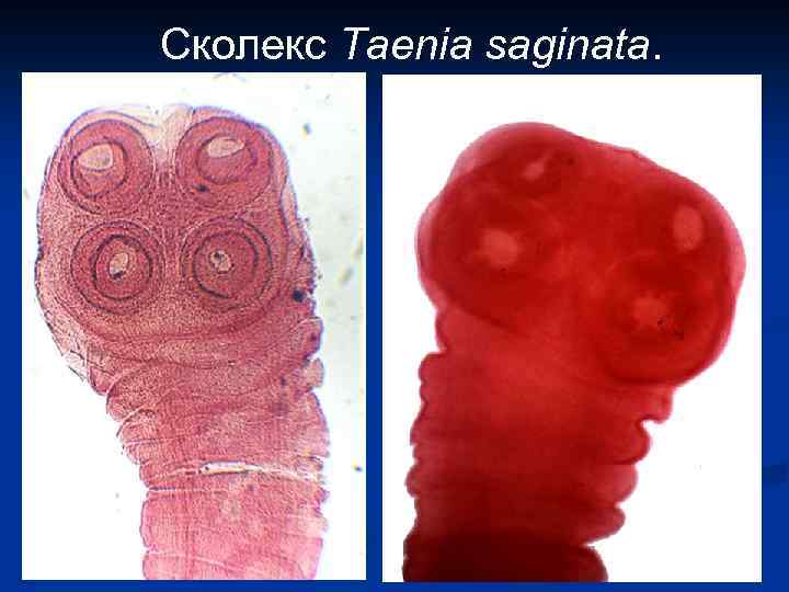 Сколекс Taenia saginata. 