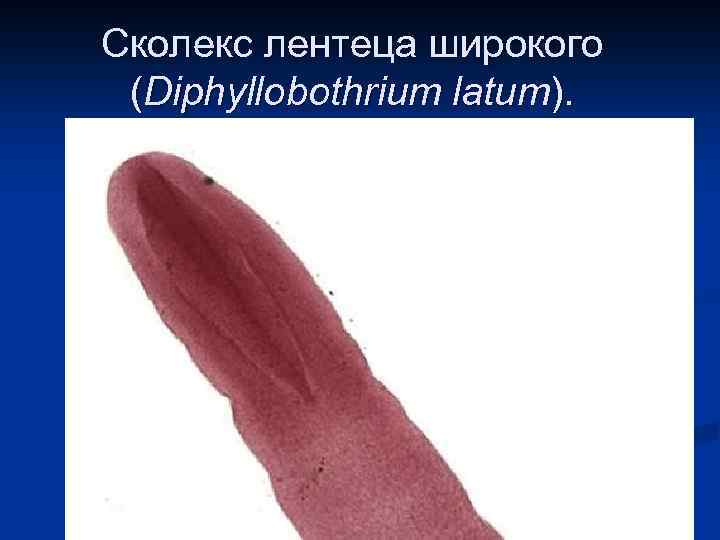 Сколекс лентеца широкого (Diphyllobothrium latum). 