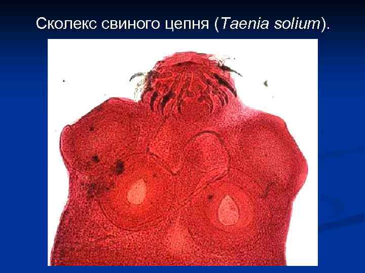 Сколекс свиного цепня (Taenia solium). 