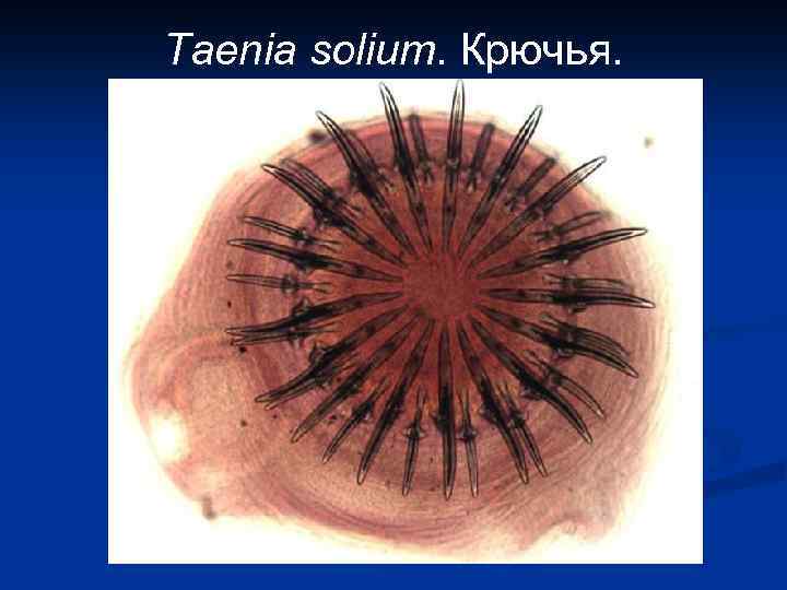 Taenia solium. Крючья. 