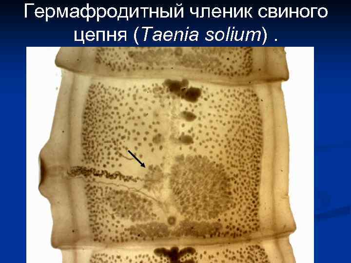 Гермафродитный членик свиного цепня (Taenia solium). 