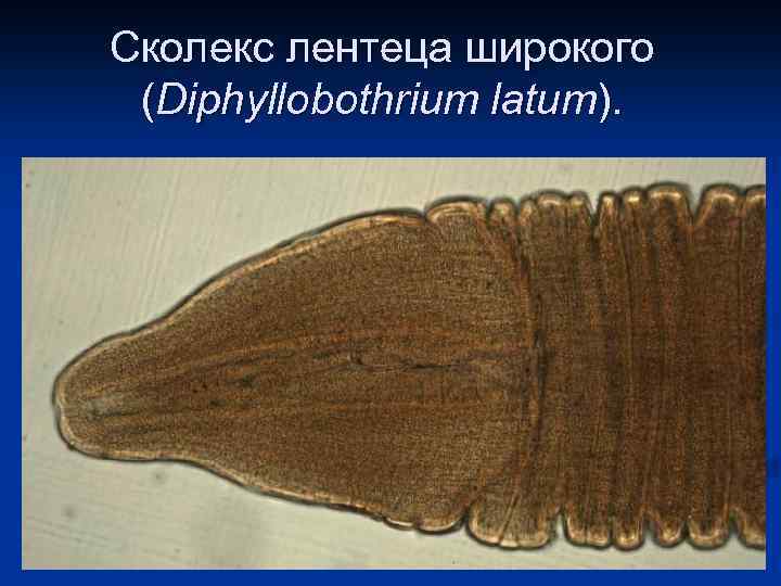 Сколекс лентеца широкого (Diphyllobothrium latum). 