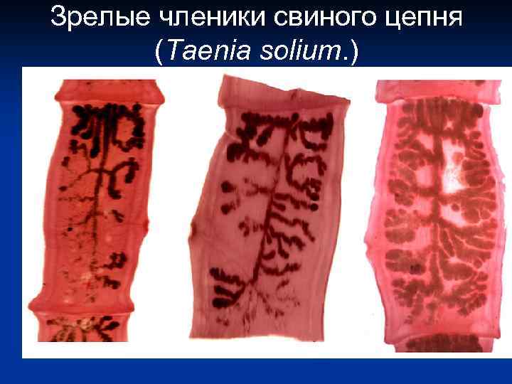 Зрелые членики свиного цепня (Taenia solium. ) 