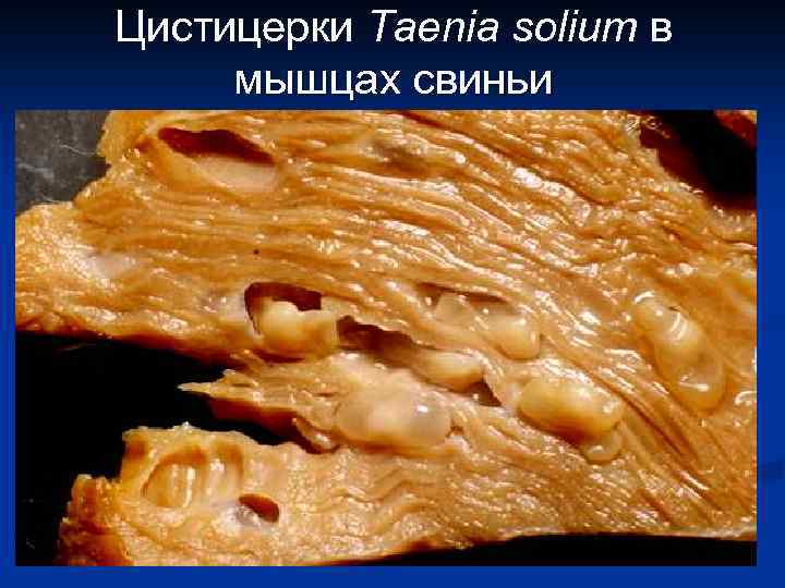 Цистицерки Taenia solium в мышцах свиньи 