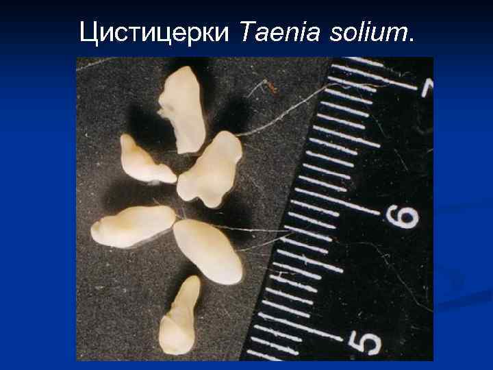 Цистицерки Taenia solium. 