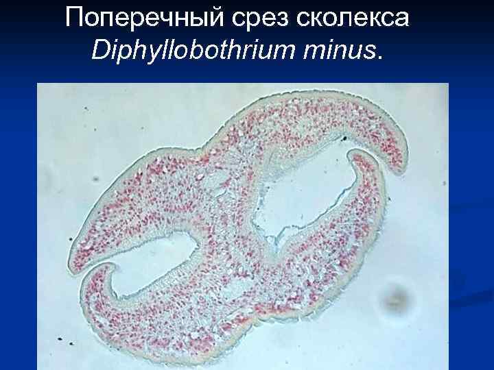 Поперечный срез сколекса Diphyllobothrium minus. 