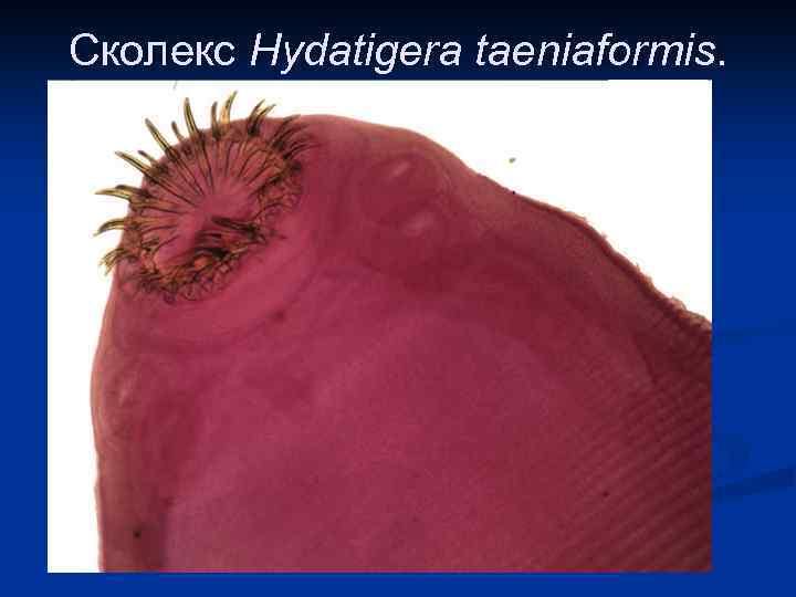 Сколекс Hydatigera taeniaformis. 