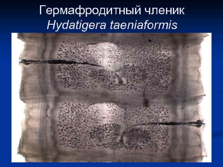 Гермафродитный членик Hydatigera taeniaformis 