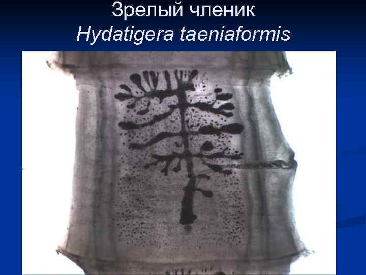 Зрелый членик Hydatigera taeniaformis 