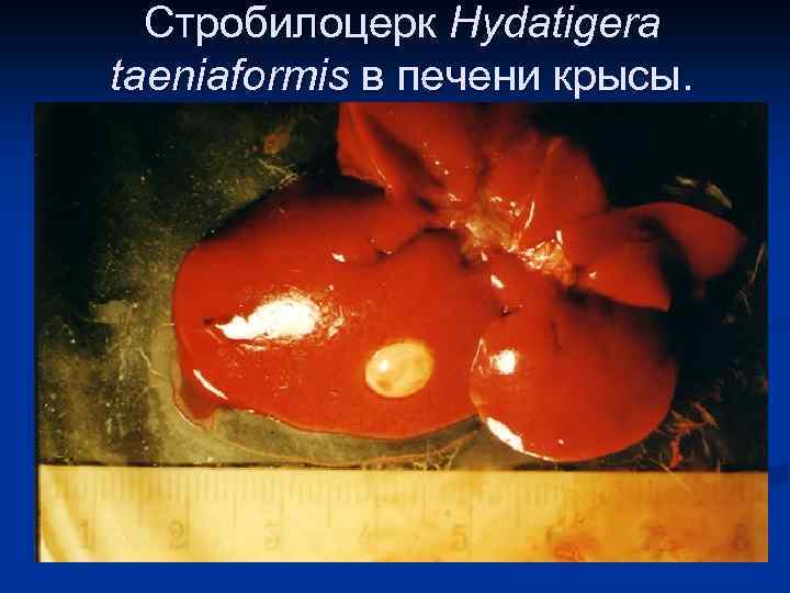 Стробилоцерк Hydatigera taeniaformis в печени крысы. 