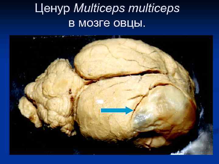 Ценур Multiceps multiceps в мозге овцы. 