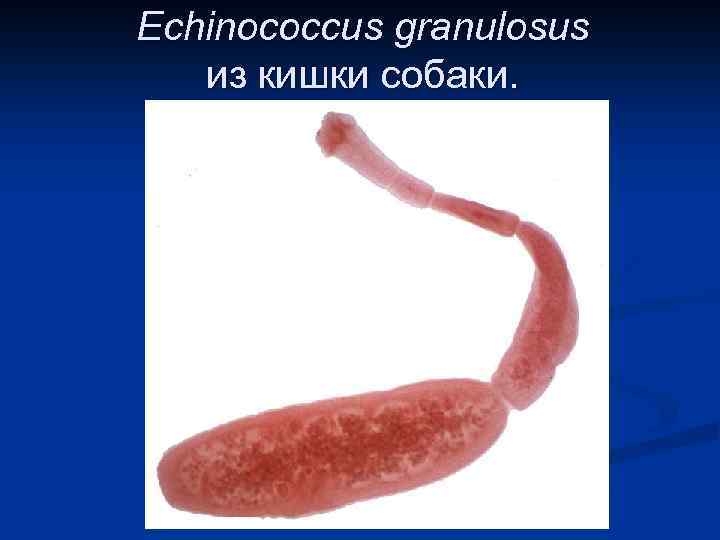 Echinococcus granulosus из кишки собаки. 