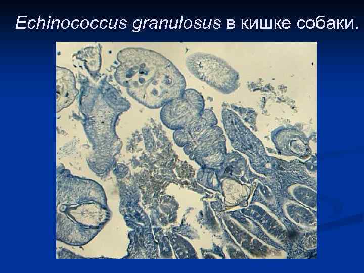 Echinococcus granulosus в кишке собаки. 