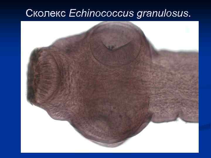 Сколекс Echinococcus granulosus. 