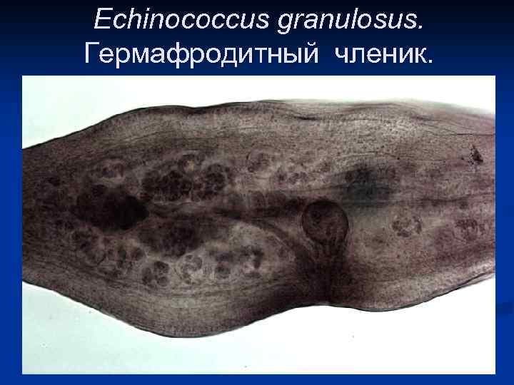 Echinococcus granulosus. Гермафродитный членик. 