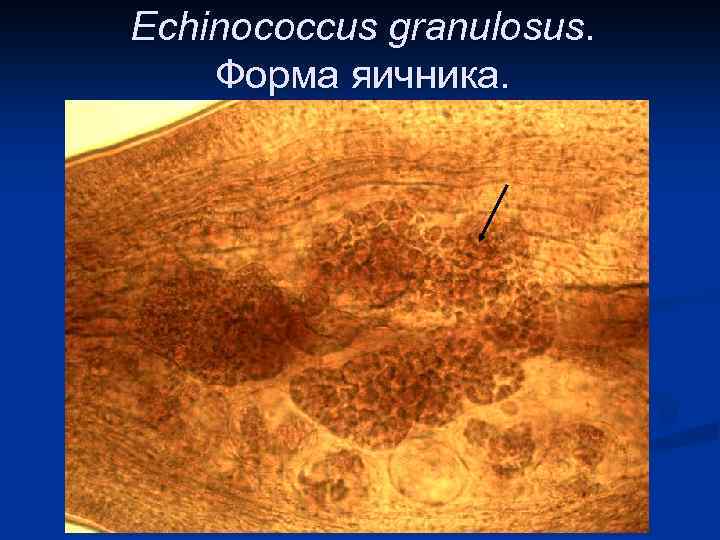 Echinococcus granulosus. Форма яичника. 