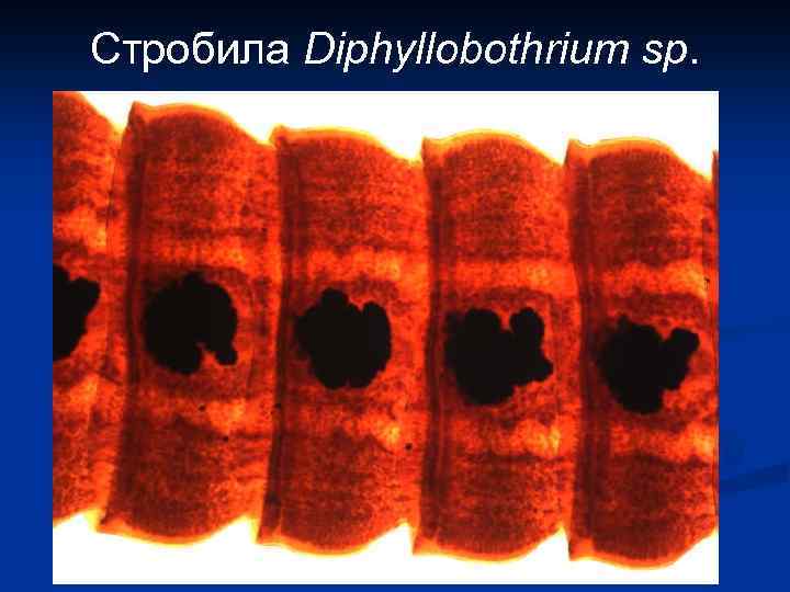 Стробила Diphyllobothrium sp. 