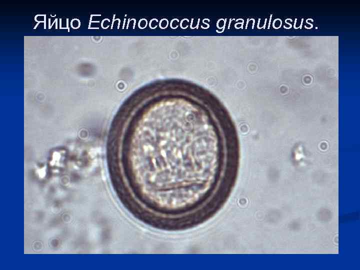 Яйцо Echinococcus granulosus. 