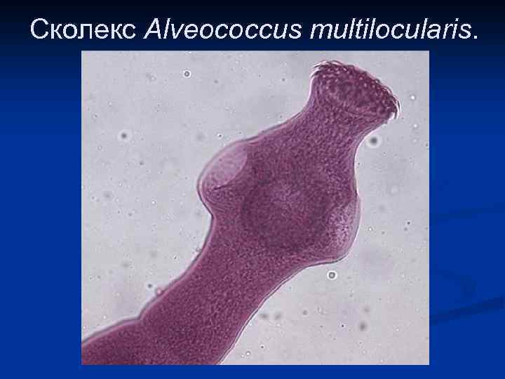 Сколекс Alveococcus multilocularis. 