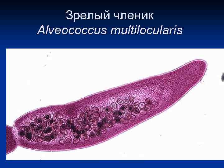 Зрелый членик Alveococcus multilocularis 