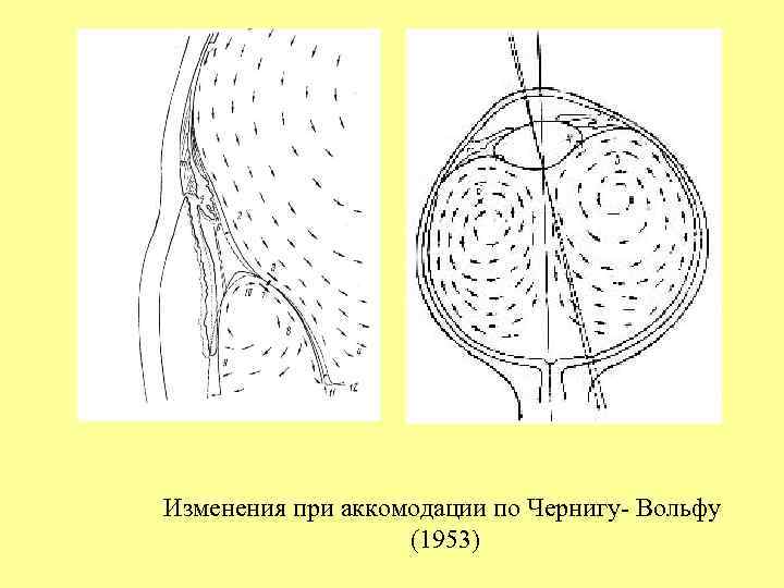 Изменения при аккомодации по Чернигу- Вольфу (1953) 