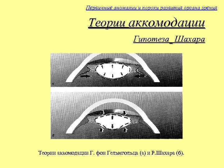 Первичные аномалии и пороки развития органа зрения Теории аккомодации Гипотеза Шахара Теории аккомодации Г.