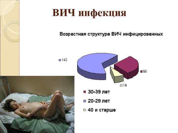 ВИЧ инфекция 