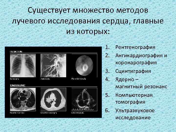 Существует множество методов лучевого исследования сердца, главные из которых: 1. Рентгенография 2. Ангикардиография и