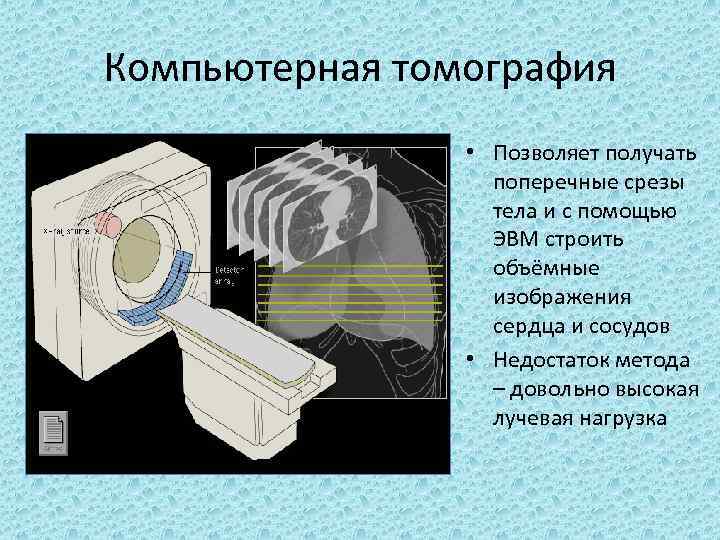 Принципы получения изображения