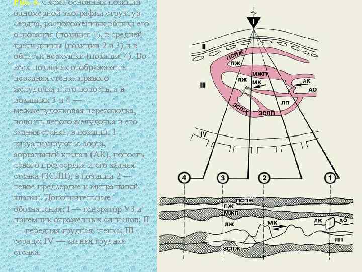 Рис. 3. Схема основных позиций одномерной эхографии структур сердца, расположенных вблизи его основания (позиция