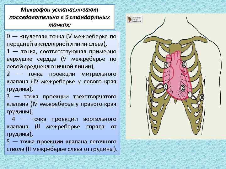 Микрофон устанавливают последовательно в 6 стандартных точках: 0 — «нулевая» точка (V межреберье по