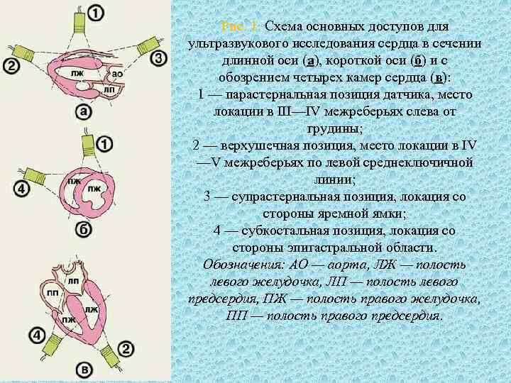 Рис. 1. Схема основных доступов для ультразвукового исследования сердца в сечении длинной оси (а),